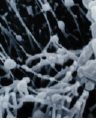 Une mutation de la dynactine 4 aggrave la mucoviscidose