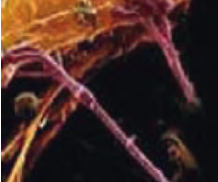 usher_et_synesthesies