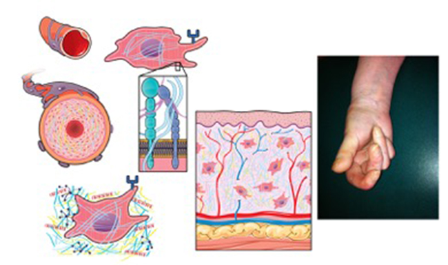 Graphical abstract