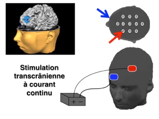 Graphical abstract