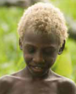 TYRP1 chez les enfants blonds des îles Salomon