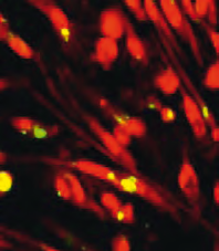 Mycobacterium