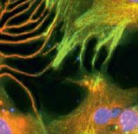 Neurones-glies : 1-1